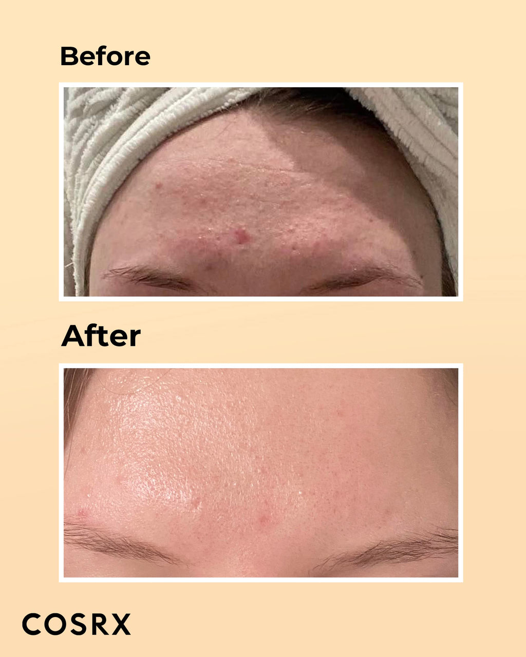 Cosrx Advanced Snail 96 Mucin Power Essence 100ml